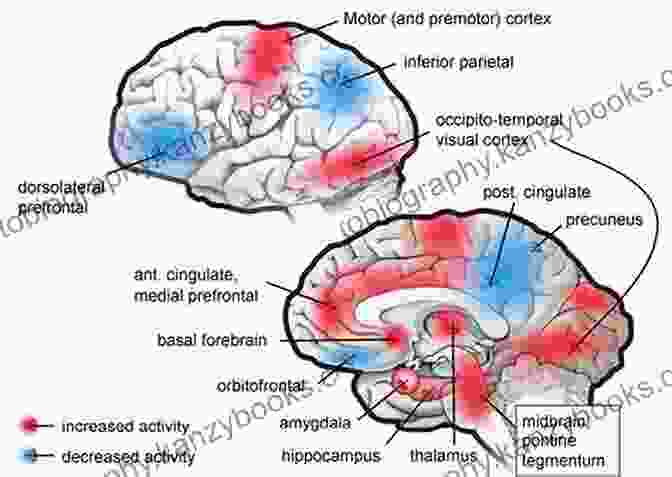 A Detailed Diagram Illustrating The Activation And Suppression Of Different Brain Regions During Dreaming. The Science Of Dreaming: Why We Dream What Dreams Mean And How To Lucid Dream