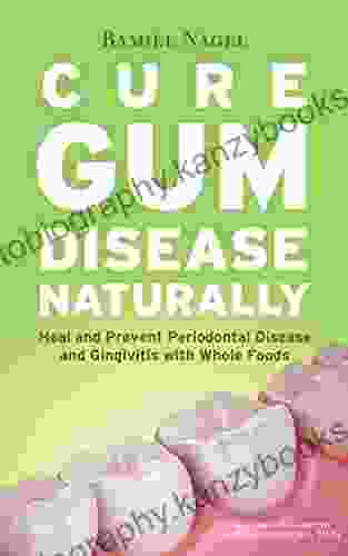 Cure Gum Disease Naturally: Heal And Prevent Periodontal Disease And Gingivitis With Whole Foods