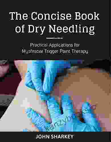 The Concise Of Dry Needling: A Practitioner S Guide To Myofascial Trigger Point Applications